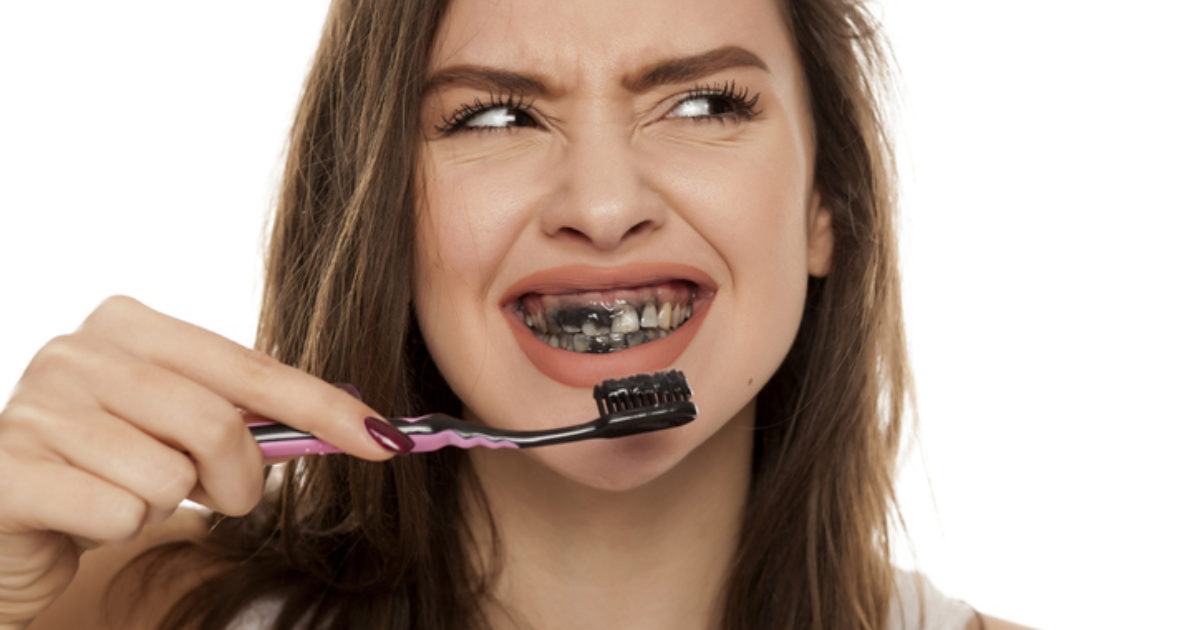 Ik heb een contract gemaakt pijpleiding vragen Je tanden bleken? Met deze trucjes pas je beter op! | GlamSmile