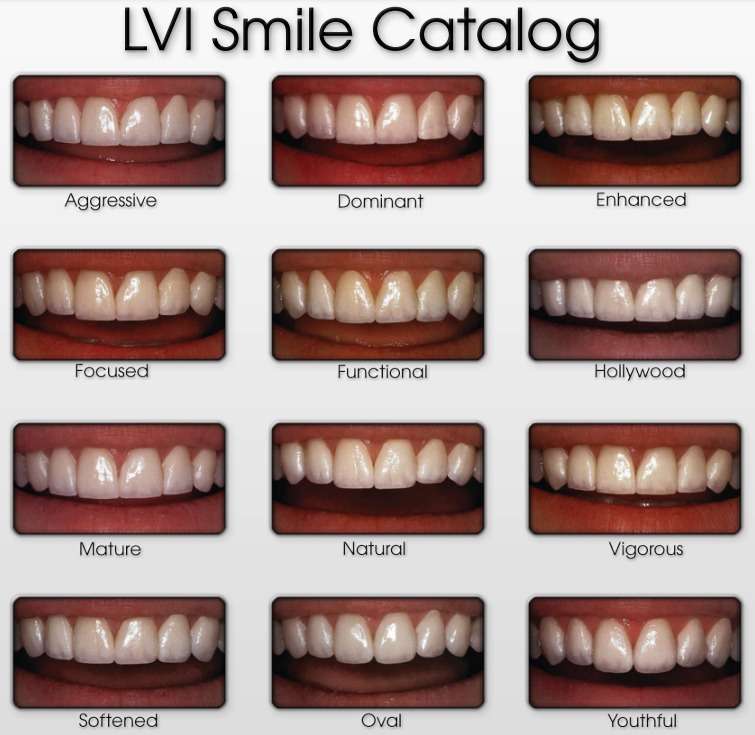 Twaalf verschillende glimlachen volgens de Las Vegas Institute Smile Catalog